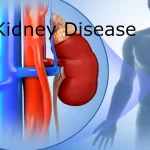 किडनी बीमारी का पता कैसे करें, Kidney Disease, Kidney Disease Signs, health news kidney, kidney damage, किडनी रोगियों के लक्षण, किडनी खराब होनका पहला संकेत, किडनी की बीमारी के संकेत, किडनी में सूजन के लक्षण, Kidney bimari ke lakshan kya hai, Kidney me sujan