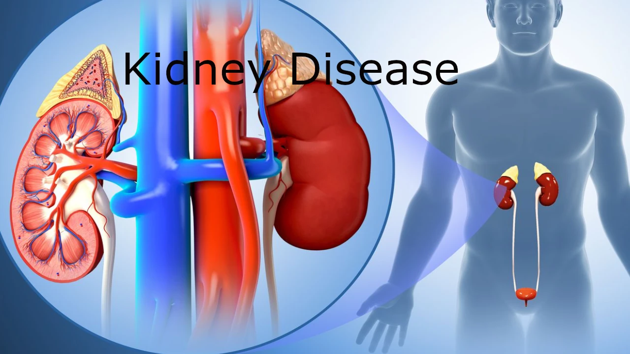 किडनी बीमारी का पता कैसे करें, Kidney Disease, Kidney Disease Signs, health news kidney, kidney damage, किडनी रोगियों के लक्षण, किडनी खराब होनका पहला संकेत, किडनी की बीमारी के संकेत, किडनी में सूजन के लक्षण, Kidney bimari ke lakshan kya hai, Kidney me sujan